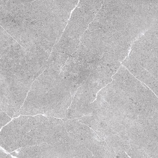 CERAMICA CTF 45454 (45*45) 2.25 M2 (64CJS*P)